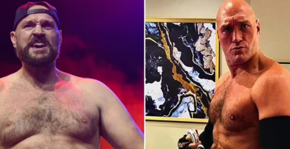 Tyson Fury e ka marrë shumë seriozisht luftën me Usyk – transformim shokues trupor