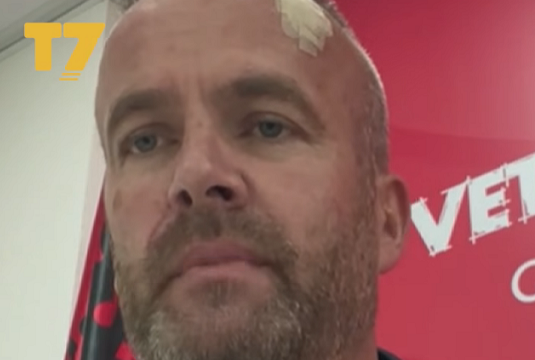 Flet Hysni Mehani në T7: Veç e kam pa Sami Lushtakun që më është afruar dhe më goditi me telefon