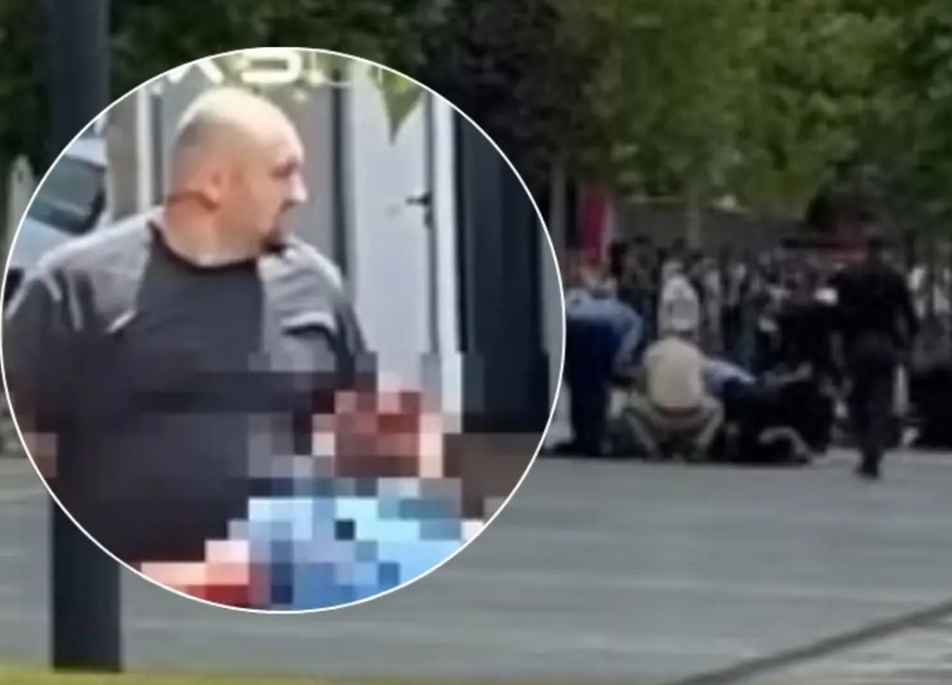 Këta janë tre të plagosurit nga të shtënat me armë në Podujevë, njëri kalimtar i rastit Këta janë tre të plagosurit nga të shtënat me armë në Podujevë, njëri kalimtar i rastit